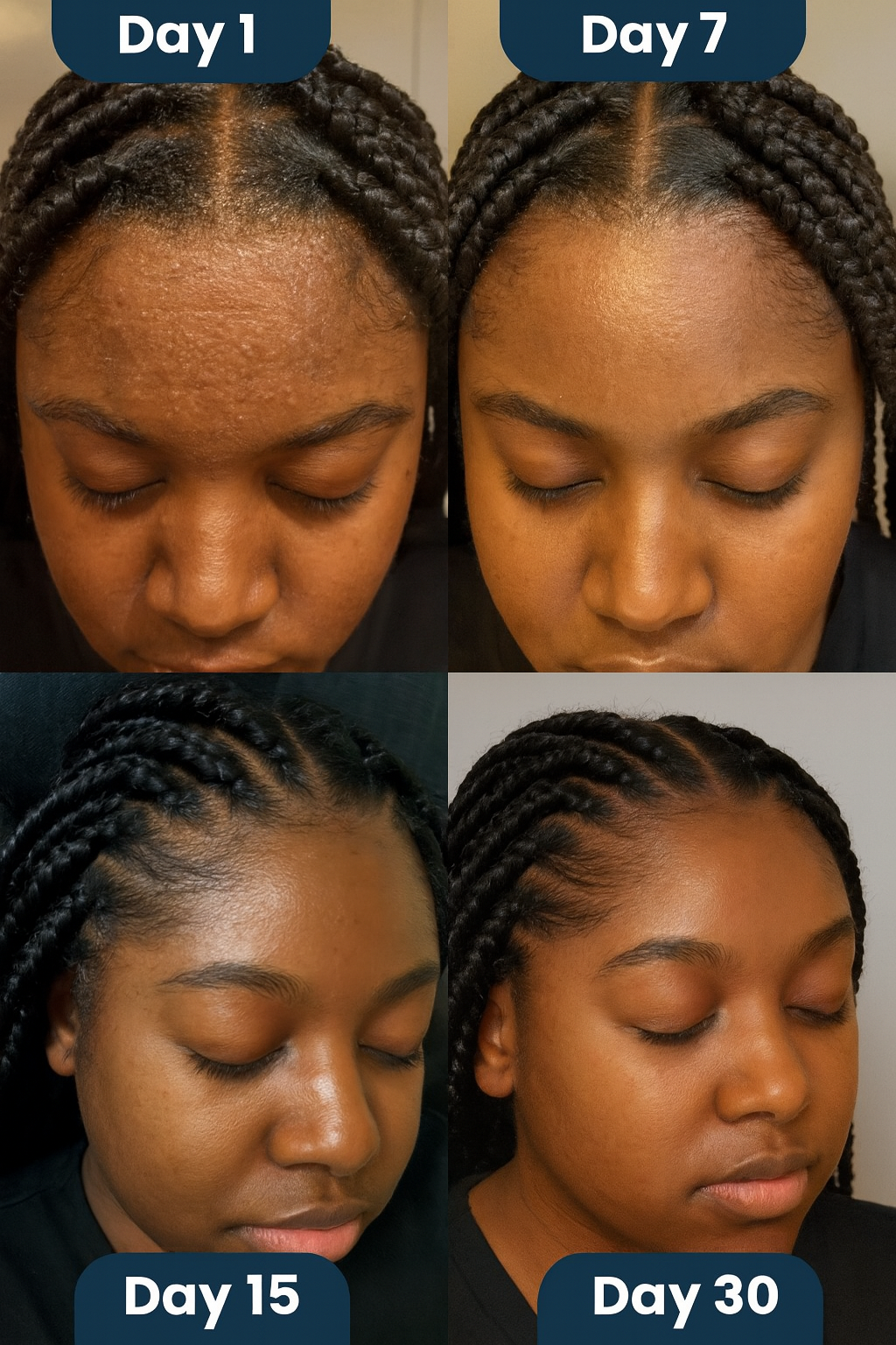 BlissBalm Scalp Relief