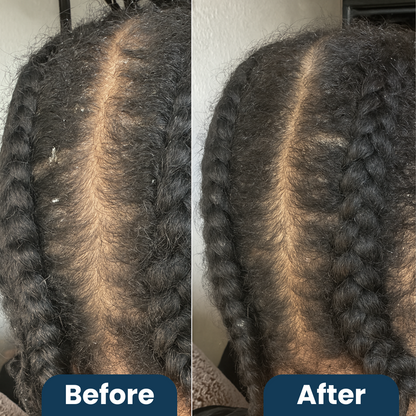 BlissBalm Scalp Relief