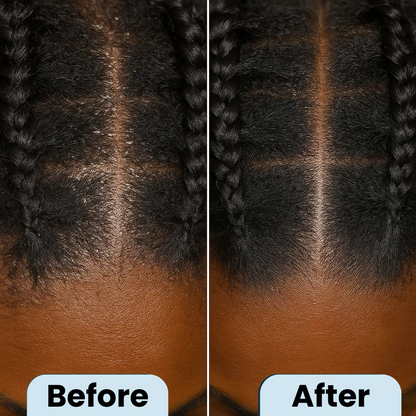 BlissBalm Flake Relief